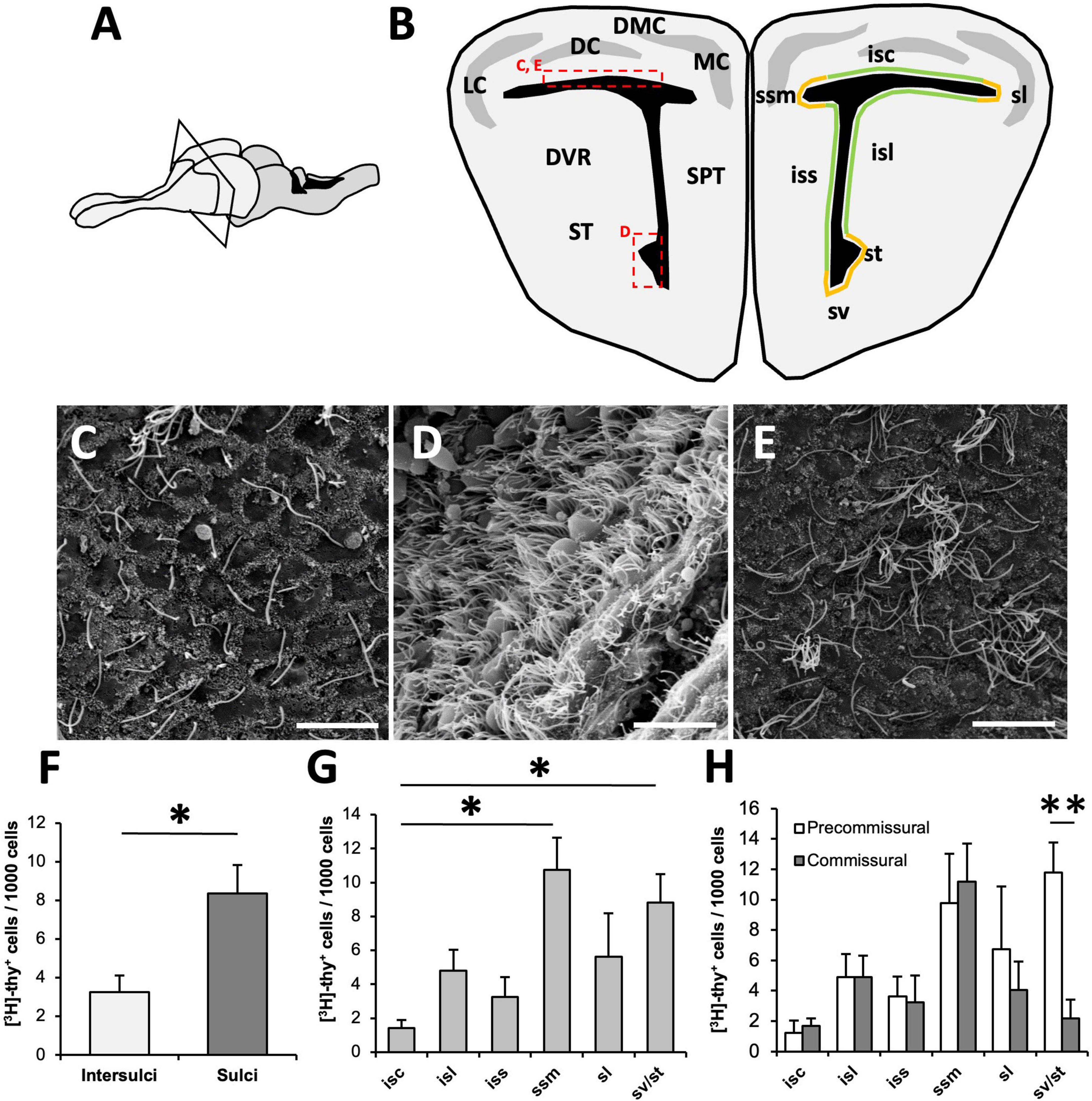 Adult neurogenesis in the telencephalon of the lizard Podarcis liolepis